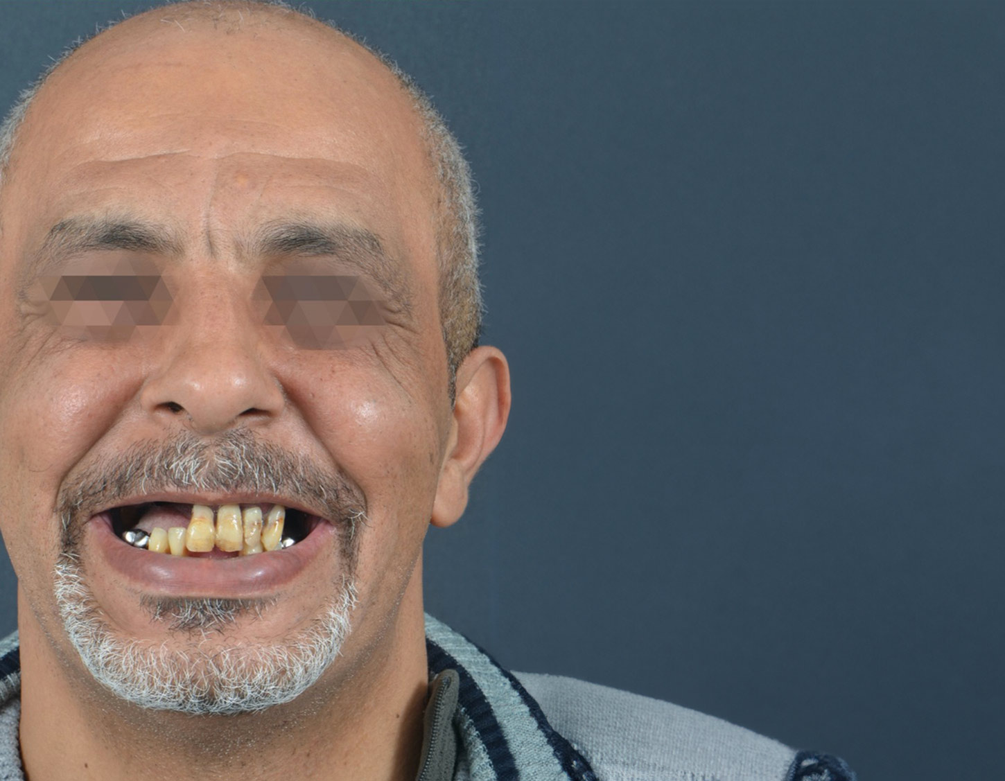 chico-antes-de-cambio