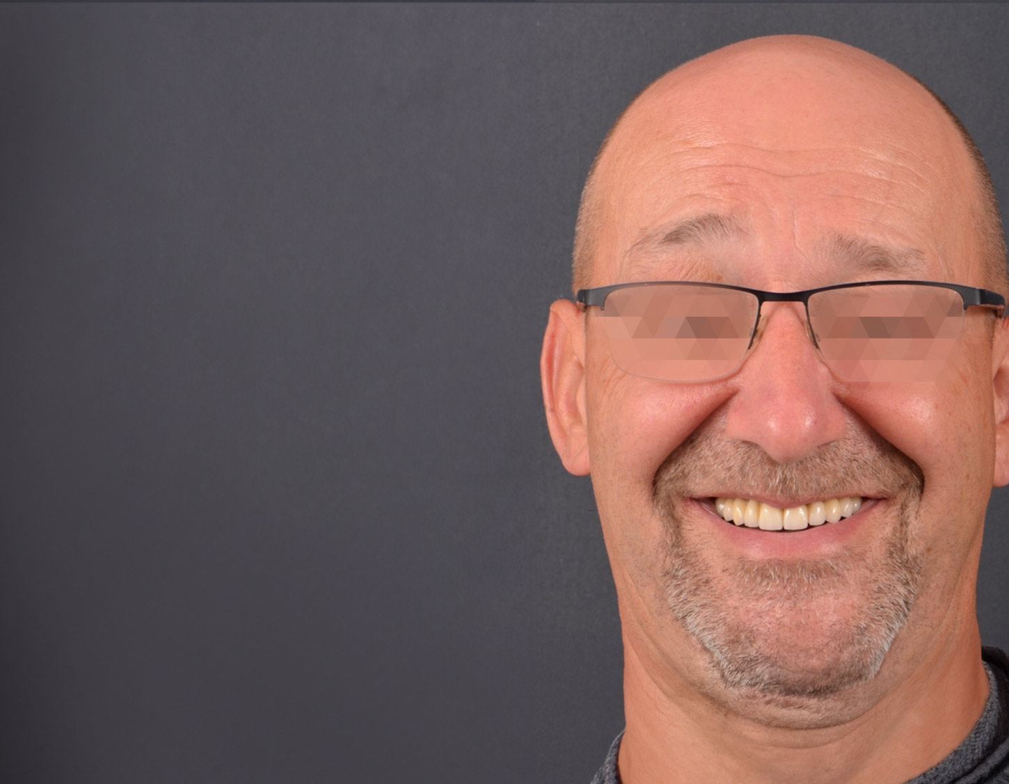 chico-antes-de-operacion