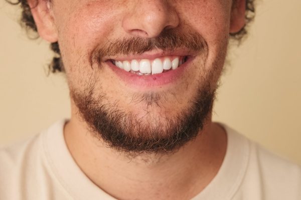 chico-con-barba-soriendo-con-dientes-blancos