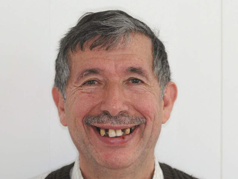 hombre-pelo-gris-antes