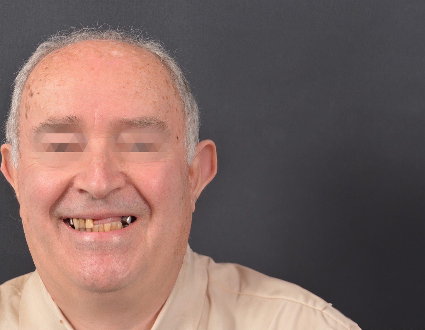 senor-antes-de-cambio