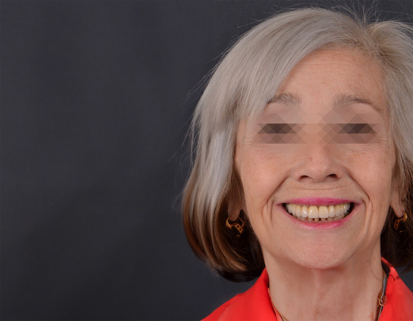 senora-despues-de-cambio