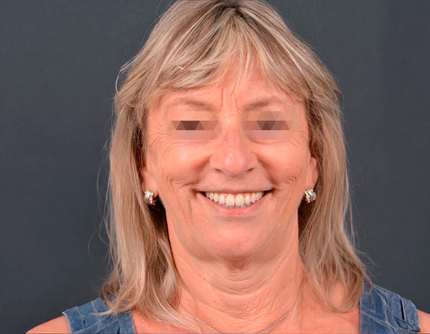 senora-rubia-2-despuees